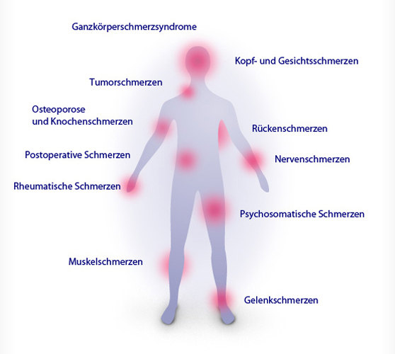 Schmerzarten - Schmerzpraxis Böblingen